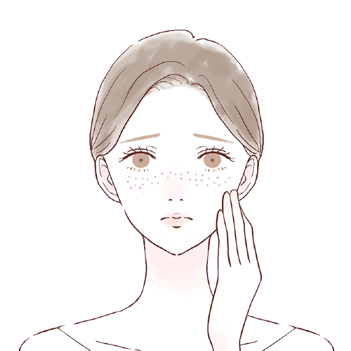 そばかす 雀卵斑